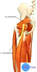 piriformis